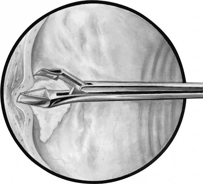 B. Braun SCHUMACHER Biopsy Forceps, small, straight, 305 mm (12"), work. length: 240 mm, jaw width: 8.50 mm (ER063R)