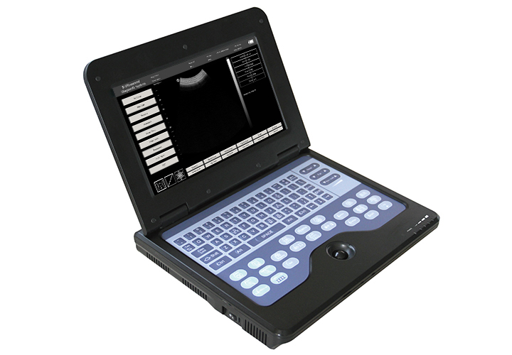 CONTEC CMS600P2 B-Ultrasound Diagnostic System