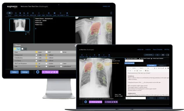 DeepTek Augmento X-Ray manufacturer software presentation; computers shown are reference illustrations, not an included hardware package