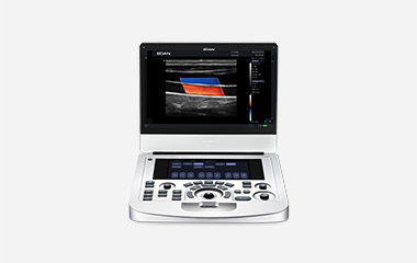 EDAN Acclarix AX3 portable ultrasound system, light-coloured, with a colour Doppler image on the screen