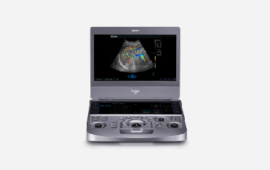 EDAN Acclarix AX9 portable ultrasound system with colour Doppler image on the screen and a full control panel