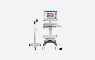 EDAN video colposcope camera on a floor stand beside a workstation with monitor, keyboard and footswitch