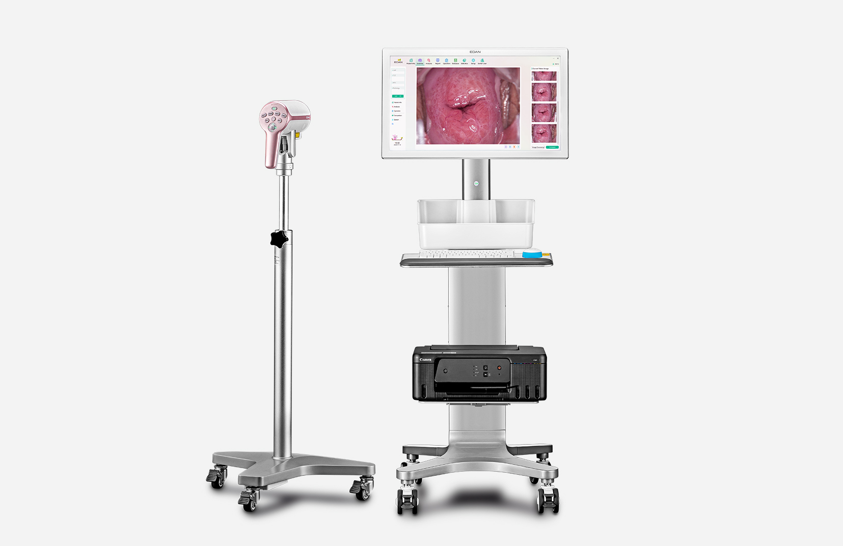 EDAN C9 UHD and C12 UHD Video Colposcopes