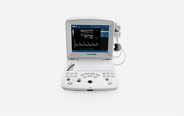 EDAN DUS60 laptop-style portable ultrasound system with a spectral trace on the screen and a probe attached