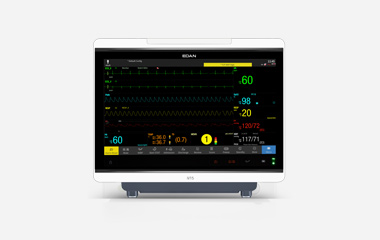 EDAN iV Series modular patient monitor with a large display showing vital-sign waveforms