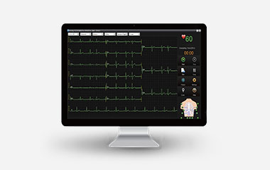 EDAN SE-1515 ECG Workstation