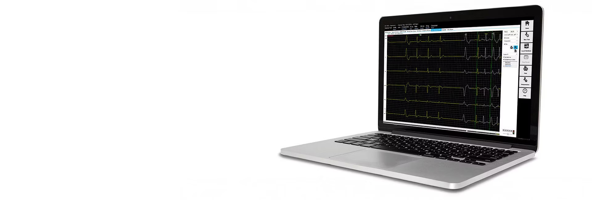 GE HealthCare CardioSoft V7 SP7 Stress Testing System, official product image