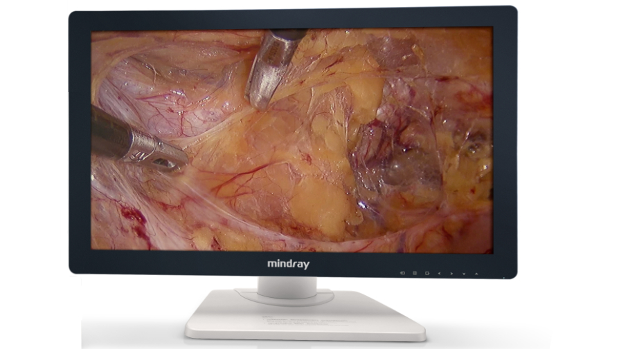 Mindray PV27 Full HD endoscopy display, manufacturer component reference; supplied accessories to specify