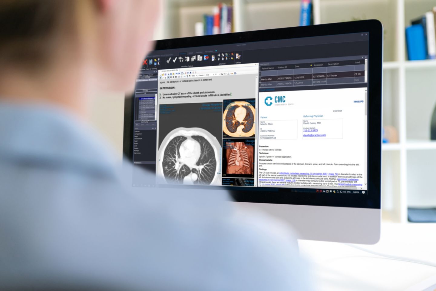 Philips Image Management diagnostic reading and reporting workspace on a monitor, official manufacturer product-family image