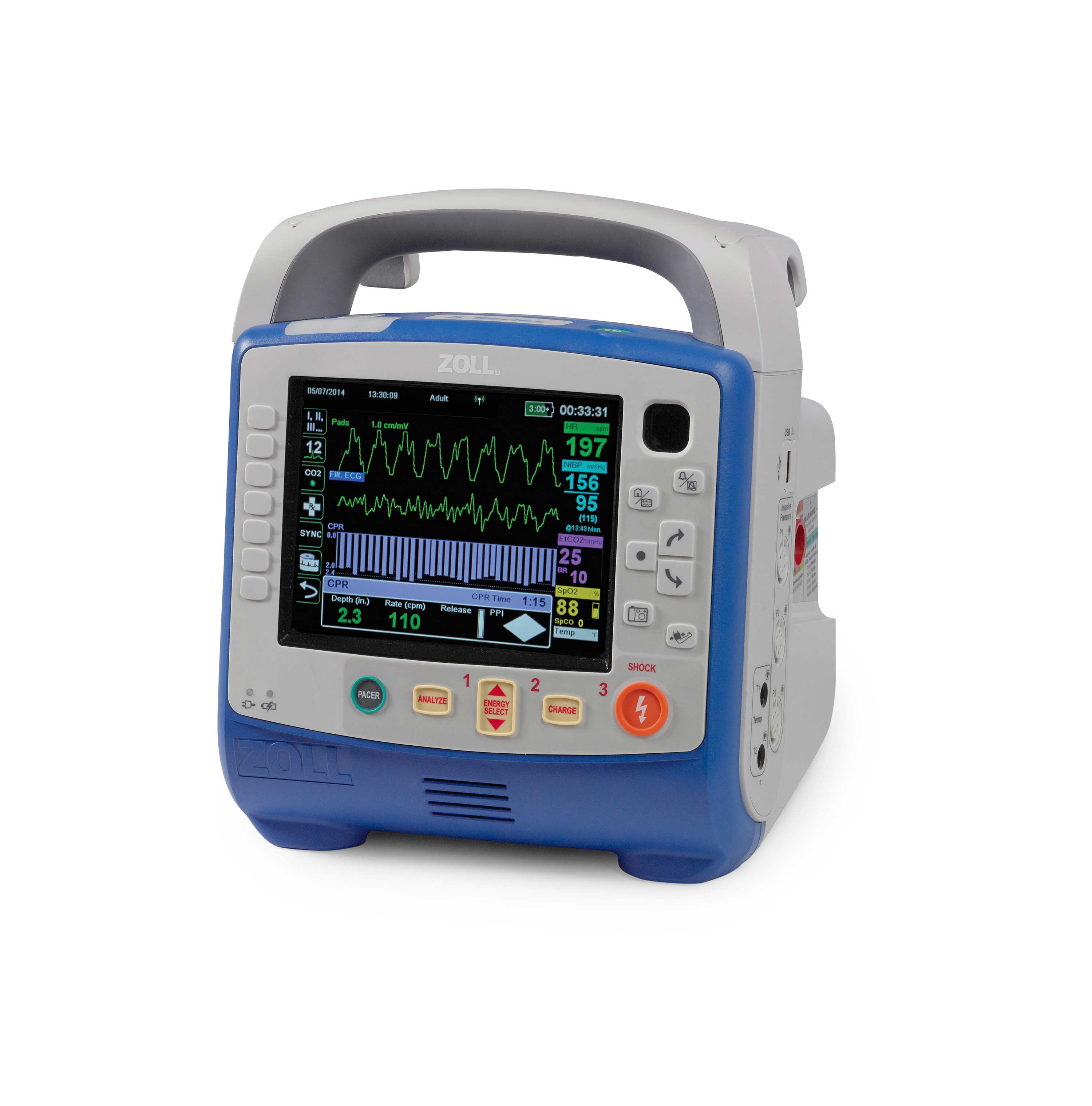 ZOLL X Series monitor/defibrillator