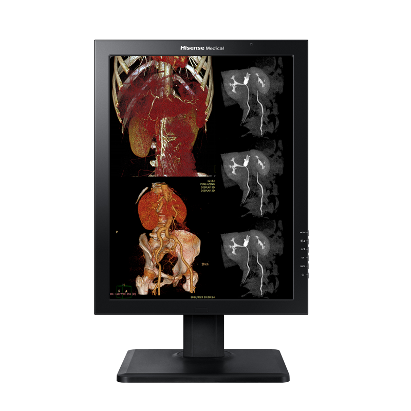 Hisense Medical HMD2C21A 2MP color diagnostic monitor displaying medical images