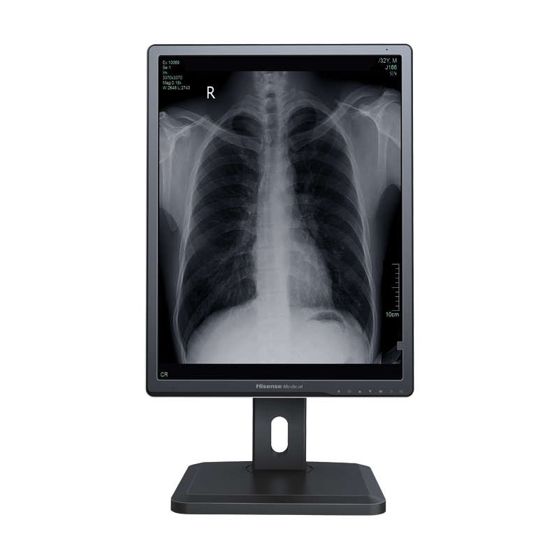 Hisense Medical HMD2G21S 2MP monochrome diagnostic monitor displaying a radiology image