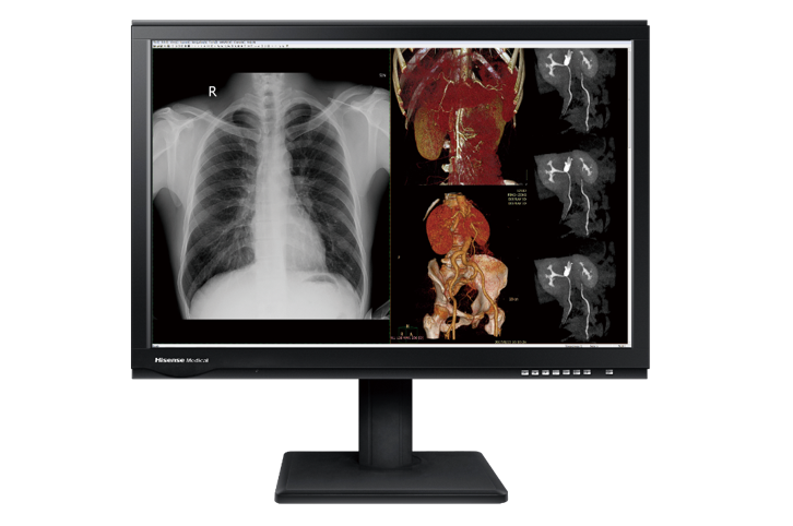 Hisense Medical HMD4C27S 4MP color diagnostic monitor