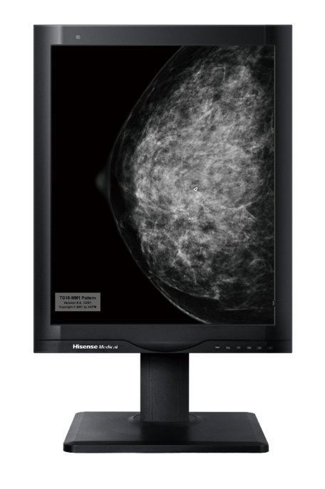 Hisense Medical HMD5G21S 5MP monochrome diagnostic monitor displaying a mammography image