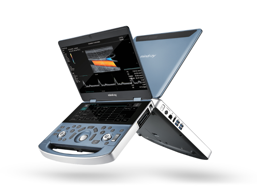 Mindray MX7 laptop-format ultrasound system, front and rear reference views